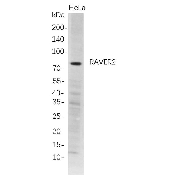 U-Blot® RAVER2 Rabbit Monoclonal Antibody – Figure 1 of 1