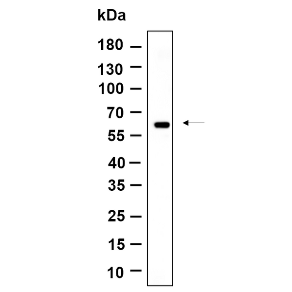 U-Blot® Cytokeratin 10 Rabbit Monoclonal Antibody – Figure 1 of 1