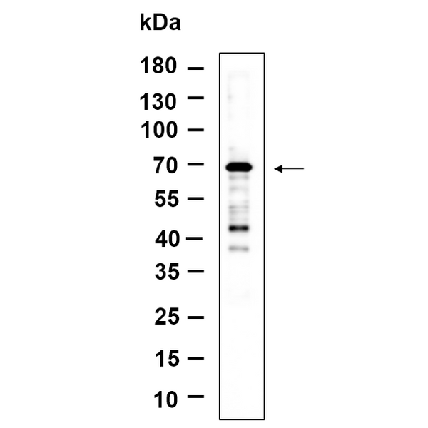 U-Blot® NF2 Rabbit Monoclonal Antibody – Figure 1 of 1