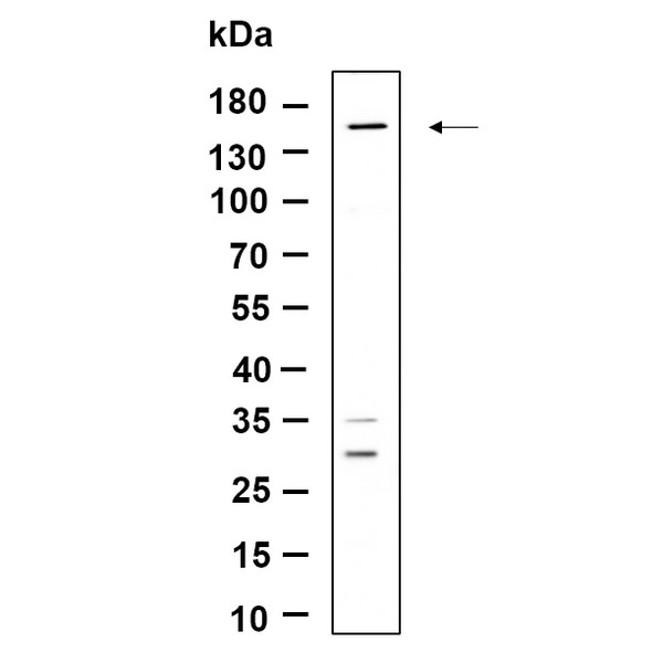 U-Blot® Drosha Rabbit Monoclonal Antibody – Figure 1 of 1