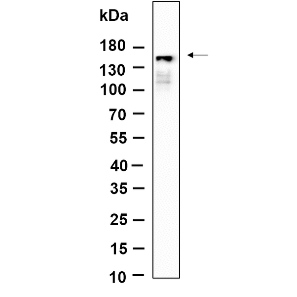 U-Blot® PLCγ1 (Phospho Tyr783) Rabbit Monoclonal Antibody – Figure 1 of 1