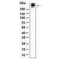 U-Blot® Acetyl-CoA Carboxylase (Phospho Ser79) Rabbit Monoclonal Antibody – Figure 1 of 1