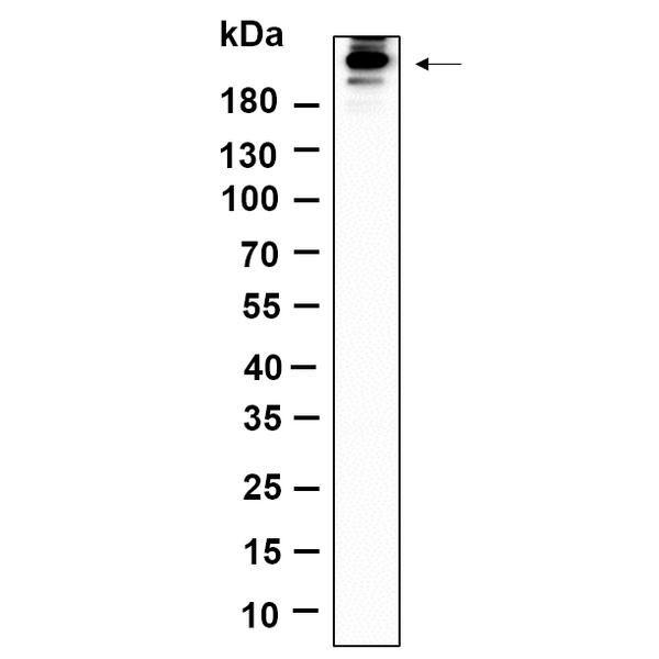 U-Blot® Acetyl-CoA Carboxylase (Phospho Ser79) Rabbit Monoclonal Antibody – Figure 1 of 1