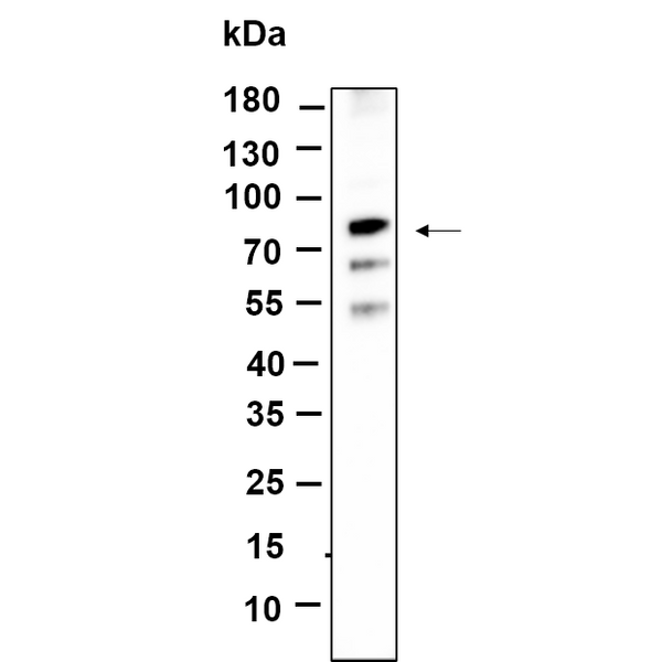U-Blot® NGFR p75 Rabbit Monoclonal Antibody – Figure 1 of 1
