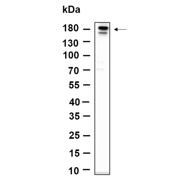 U-Blot® ErbB-3 (Phospho Tyr1289) Rabbit Monoclonal Antibody – Figure 1 of 1
