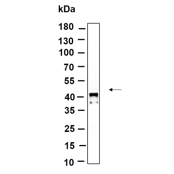U-Blot® IκB-α (Phospho Ser32) Rabbit Monoclonal Antibody – Figure 1 of 1