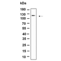 U-Blot® DDR1 Rabbit Monoclonal Antibody – Figure 1 of 1