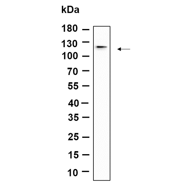 U-Blot® DDR1 Rabbit Monoclonal Antibody – Figure 1 of 1