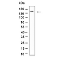 U-Blot® SMC3 Rabbit Monoclonal Antibody – Figure 1 of 1