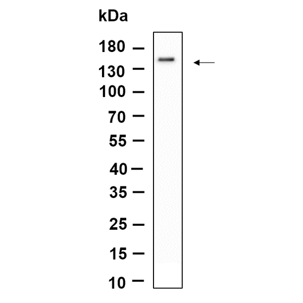 U-Blot® SMC3 Rabbit Monoclonal Antibody – Figure 1 of 1