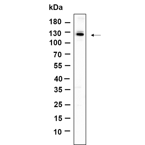 U-Blot® Dnmt3a Rabbit Monoclonal Antibody – Figure 1 of 1
