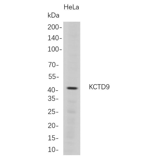 U-Blot® KCTD9 Rabbit Monoclonal Antibody – Figure 1 of 1