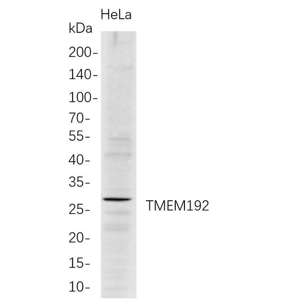 U-Blot® TMEM192 Rabbit Monoclonal Antibody – Figure 1 of 1