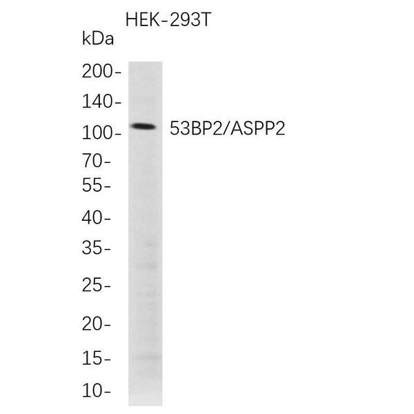 U-Blot® 53BP2/ASPP2 Rabbit Monoclonal Antibody – Figure 1 of 1