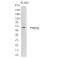 U-Blot® PTDSS2 Rabbit Monoclonal Antibody – Figure 1 of 1