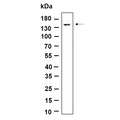 U-Blot® MDA5 Rabbit Monoclonal Antibody – Figure 1 of 1