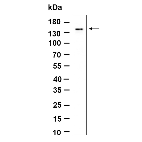 U-Blot® MDA5 Rabbit Monoclonal Antibody – Figure 1 of 1