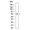 U-Blot® TXNIP Rabbit Monoclonal Antibody – Figure 1 of 1