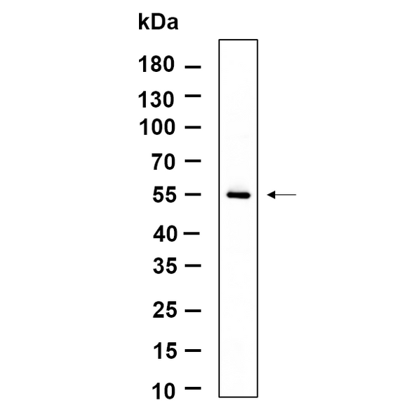 U-Blot® TXNIP Rabbit Monoclonal Antibody – Figure 1 of 1