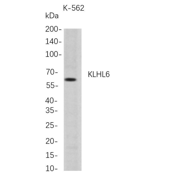 U-Blot® KLHL6 Rabbit Monoclonal Antibody – Figure 1 of 1