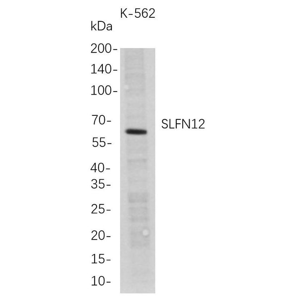 U-Blot® SLFN12 Rabbit Monoclonal Antibody – Figure 1 of 1