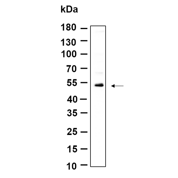 U-Blot® KRTHB3 Rabbit Monoclonal Antibody – Figure 1 of 1