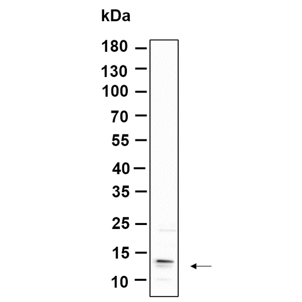 U-Blot® C17orf61 Rabbit Monoclonal Antibody – Figure 1 of 1