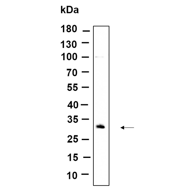 U-Blot® CDIN1 Rabbit Monoclonal Antibody – Figure 1 of 1