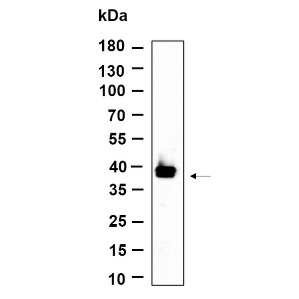 U-Blot® DBX2 Rabbit Monoclonal Antibody – Figure 1 of 1