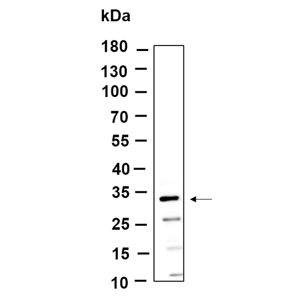 U-Blot® MTX3 Rabbit Monoclonal Antibody – Figure 1 of 1