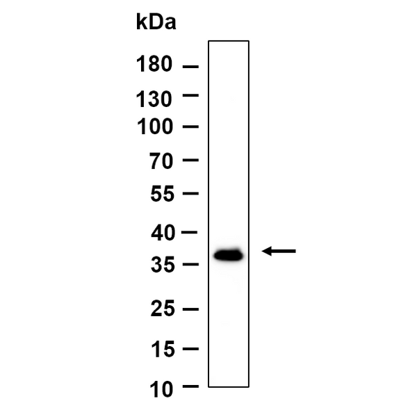 U-Blot® OXGR1 Rabbit Monoclonal Antibody – Figure 1 of 1