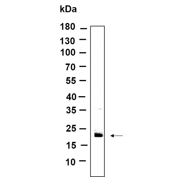 U-Blot® RAB7B Rabbit Monoclonal Antibody – Figure 1 of 1