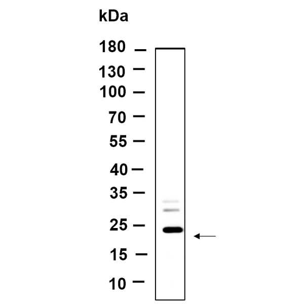 U-Blot® LHFPL5 Rabbit Monoclonal Antibody – Figure 1 of 1