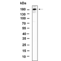 U-Blot® TIAM2 Rabbit Monoclonal Antibody – Figure 1 of 1