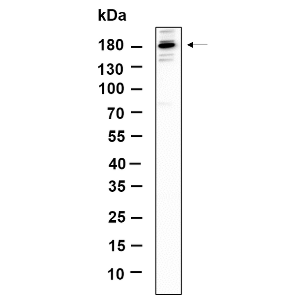 U-Blot® TIAM2 Rabbit Monoclonal Antibody – Figure 1 of 1