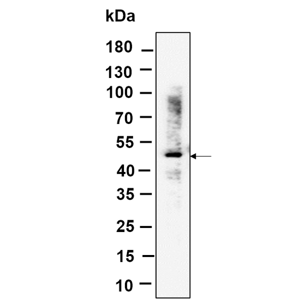 U-Blot® RGS6 Rabbit Monoclonal Antibody – Figure 1 of 1
