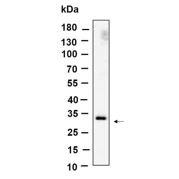 U-Blot® Nogo B receptor Rabbit Monoclonal Antibody – Figure 1 of 1