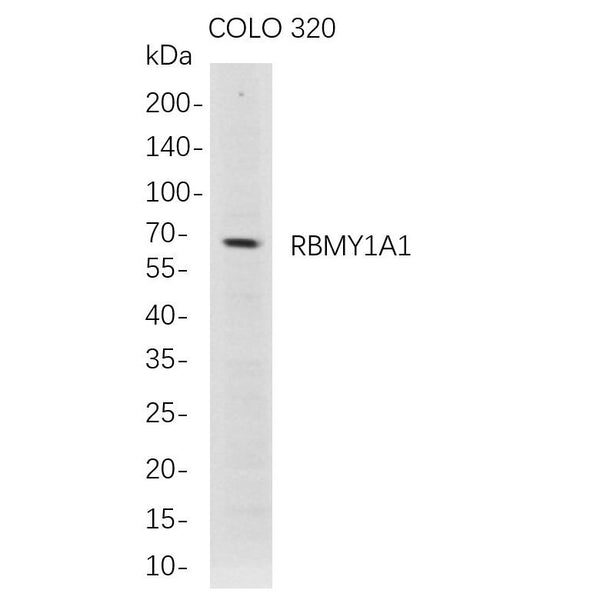 U-Blot® RBMY1A1 Rabbit Monoclonal Antibody – Figure 1 of 1