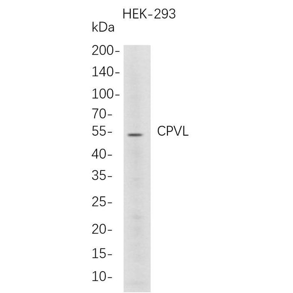 U-Blot® CPVL Rabbit Monoclonal Antibody – Figure 1 of 1