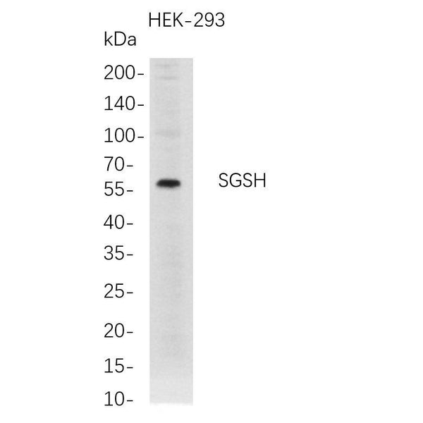 U-Blot® SGSH Rabbit Monoclonal Antibody – Figure 1 of 1