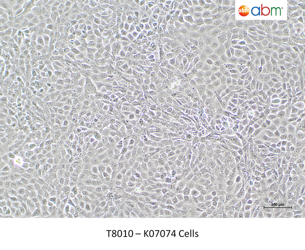 K07074 Cells – Figure 1 of 1