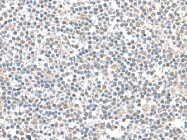 IFI27 Polyclonal Antibody – Figure 1 of 2