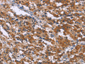 SKI Polyclonal Antibody – Figure 1 of 3