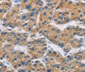 CERK Polyclonal Antibody – Figure 1 of 3