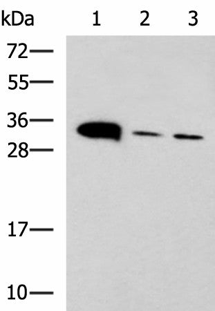 PSCA Polyclonal Antibody – Figure 1 of 3