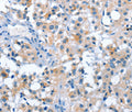 ASB2 Polyclonal Antibody – Figure 1 of 2