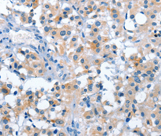 ASB2 Polyclonal Antibody – Figure 1 of 2