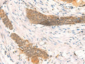 SETD1A Polyclonal Antibody – Figure 1 of 2