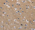 GSTA2 Polyclonal Antibody – Figure 1 of 3