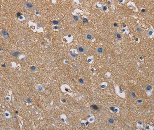 GSTA2 Polyclonal Antibody – Figure 1 of 3